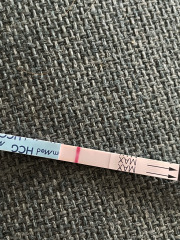 Implantation bleed - line eyes??