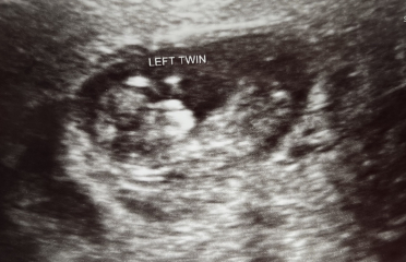 OCTOBER 2024 BABIES :) THREAD 3