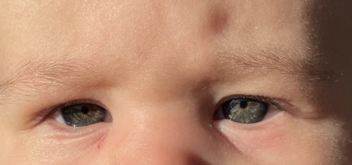 Eye colour