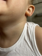 Could this be chicken pox?