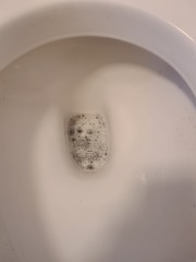 Please Help the toilet is blocked