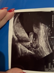 Ultrasound at 16w - can it be wrong