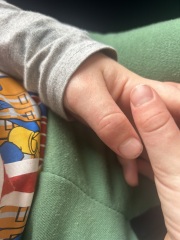 What does this rash look like on my 5 year old’s skin?