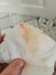 Pink/brown discharge