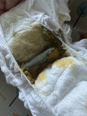 8 week old baby Neocate poo (picture)