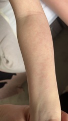 Help me figure out this rash…