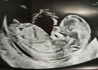 OCTOBER 2024 BABIES - Thread 4