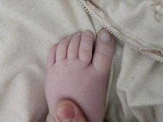 9month old with croup - blue tinge toes and weird breathing?