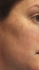 Rash on face - not there this morning - 25 weeks pregnant