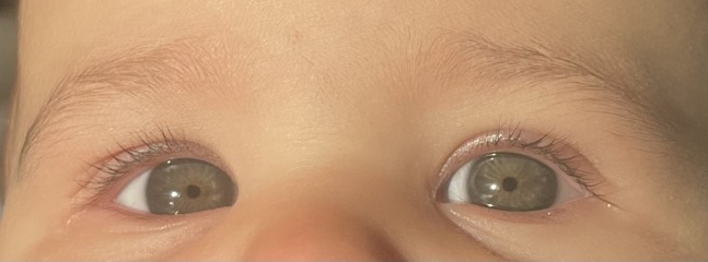 Eye colour
