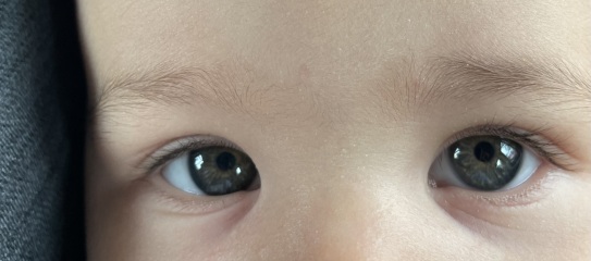 Eye colour