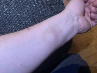 To ask medical people to look at this …