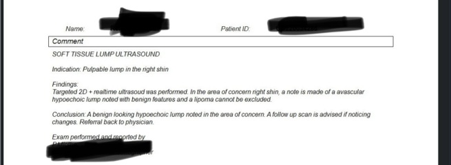 Mri results for lump I had any advice