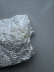 7 weeks discharge