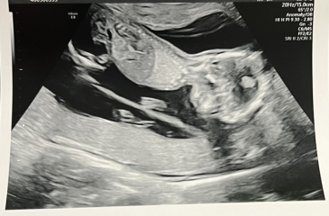 OCTOBER 2024 BABIES - Thread 4