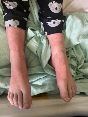 Anybody’s child have these symptoms??