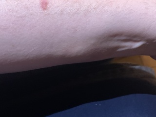 To ask medical people to look at this …
