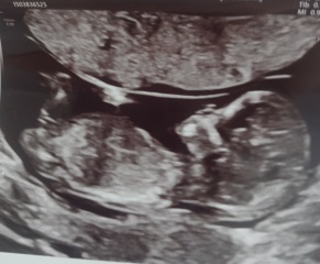 Anyone want me to take a look at their nubs?