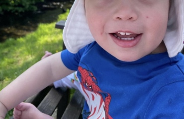 My 3 year old is getting acne