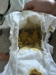 8 week old baby Neocate poo (picture)
