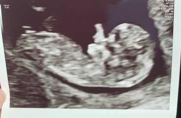 Scan pics - nub / skull theory