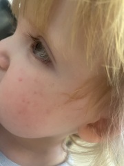 Milk allergy or colic? Warning nappy contents picture