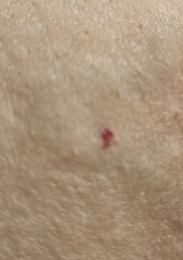What are these red marks and can I remove them