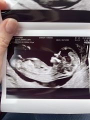 Anyone want me to take a look at their nubs?