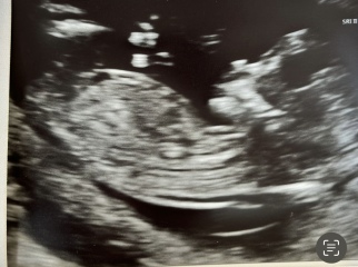 Anyone good at gender prediction- just for fun