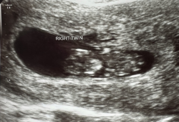 OCTOBER 2024 BABIES :) THREAD 3