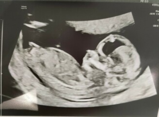 OCTOBER 2024 BABIES - Thread 4