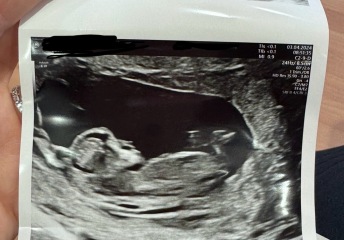 Boy or girl?