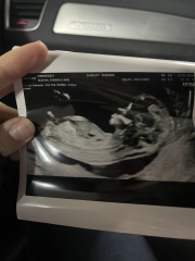 Anyone want me to take a look at their nubs?