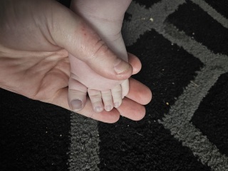 9month old with croup - blue tinge toes and weird breathing?