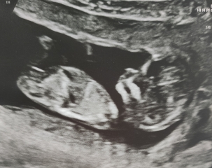 Anyone want me to take a look at their nubs?