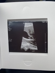 Intermittent spotting and measuring behind! (pic attached)