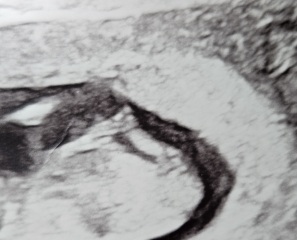 Boy or Girl:)