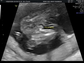 Potty Shot Confirmation?