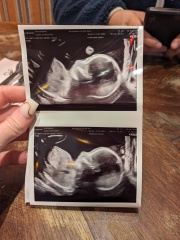 September 2024 - Thread 6! 🐣🧡💛❤️