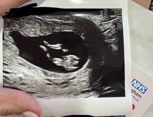 Boy or girl?