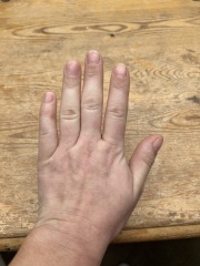 Looking for knowledge on skin cancer