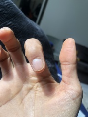 Vertical line on my fingernail