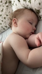 Babies skin