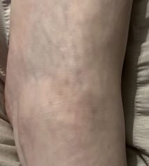 Dots on foot