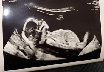 Anyone want me to take a look at their nubs?