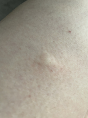 Continuing Mounjaro...part 5