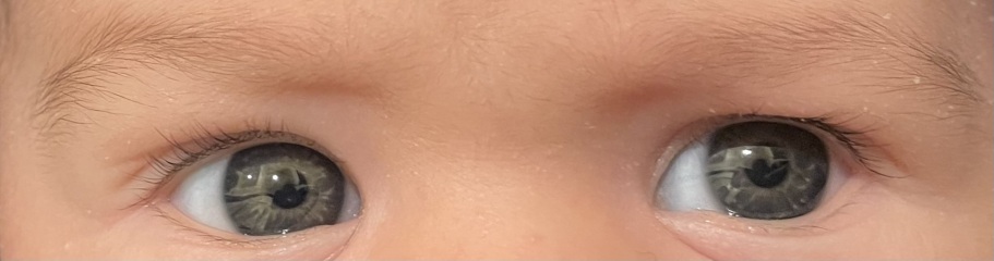 Eye colour