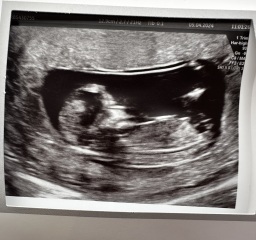 Boy or girl