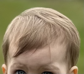 Is this normal development?