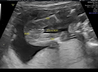 Potty Shot Confirmation?